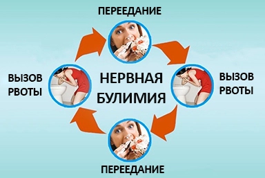 Лечение булимии в Дербенте